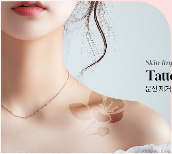 문신제거