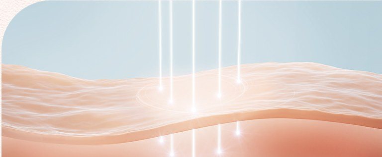 피부 시술 원리 일러스트
