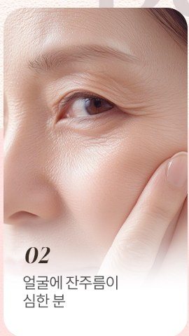 눈가 잔주름 클로즈업 사진과 02 얼굴에 잔주름이 심한 분 설명