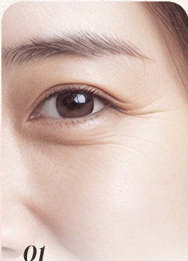 눈가 주름 부위 클로즈업