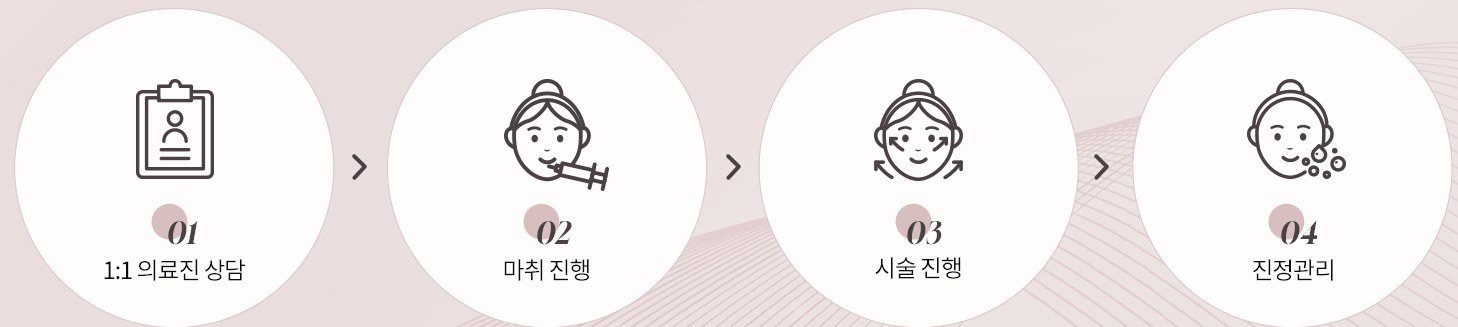 시술 과정 4단계 아이콘 (1:1 의료진 상담, 마취 진행, 시술 진행, 진정관리)